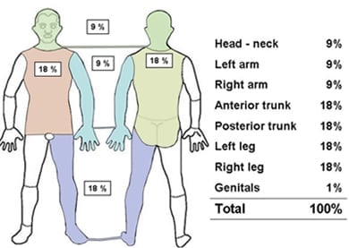 diagram utbredning av brännskada på kroppen